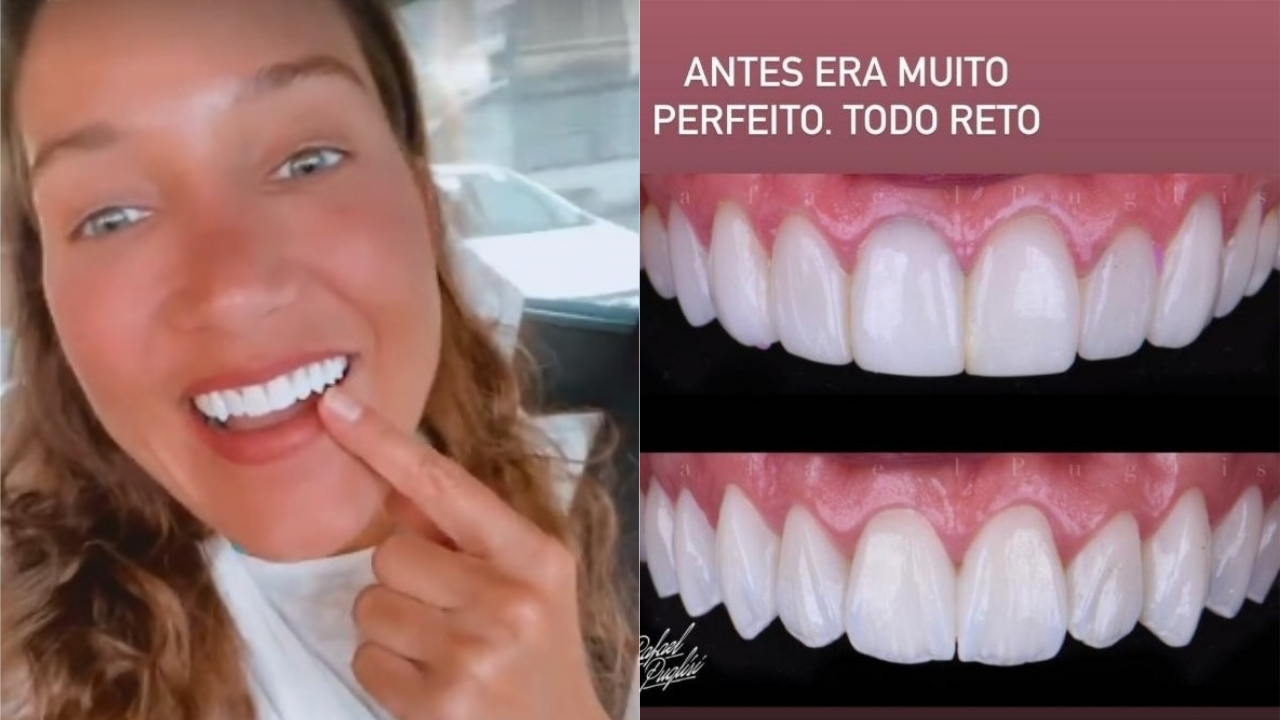 Gabriela Pugliesi faz desarmonização nos dentes Antes era muito