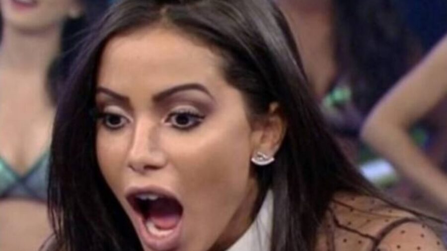 Após-sumiço,-Anitta-surge-com-rosto-transformado-e-causa-alvoroço (1)