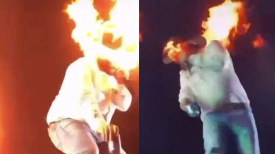 Cantor-tem-rosto-carbonizado-durante-apresentação (1)