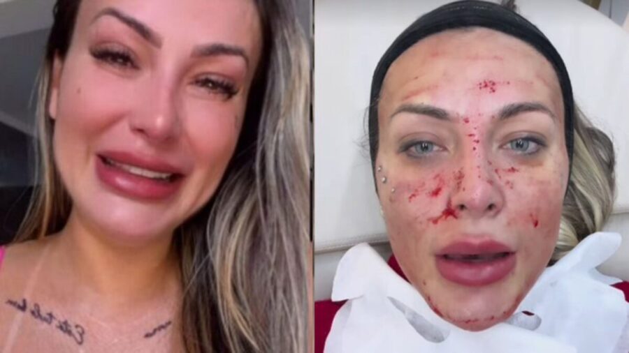 Andressa-Urach-surge-com-rosto-ensanguentado-e-choca-web (1)