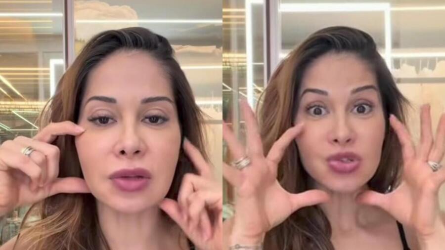 Maíra Cardi expõe deformação no rosto e anuncia cirurgia (1)